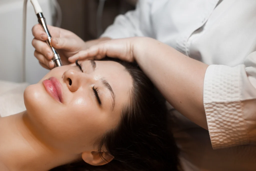 Close-up of a woman showcasing before and after results of microneedling, with visible skin improvements.